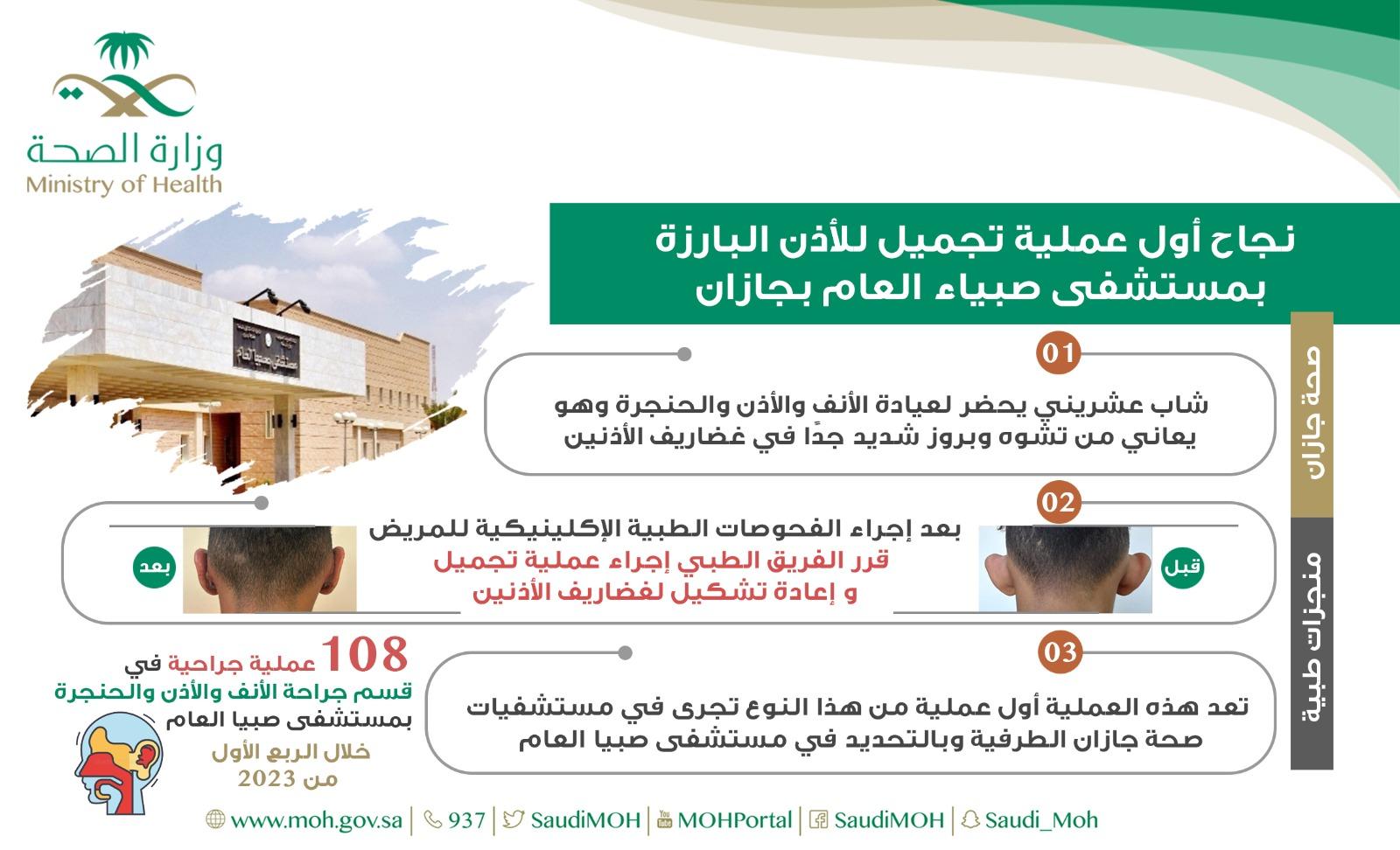 نجاح أول عملية تجميل للأذن البارزة بمستشفى صبيا العام