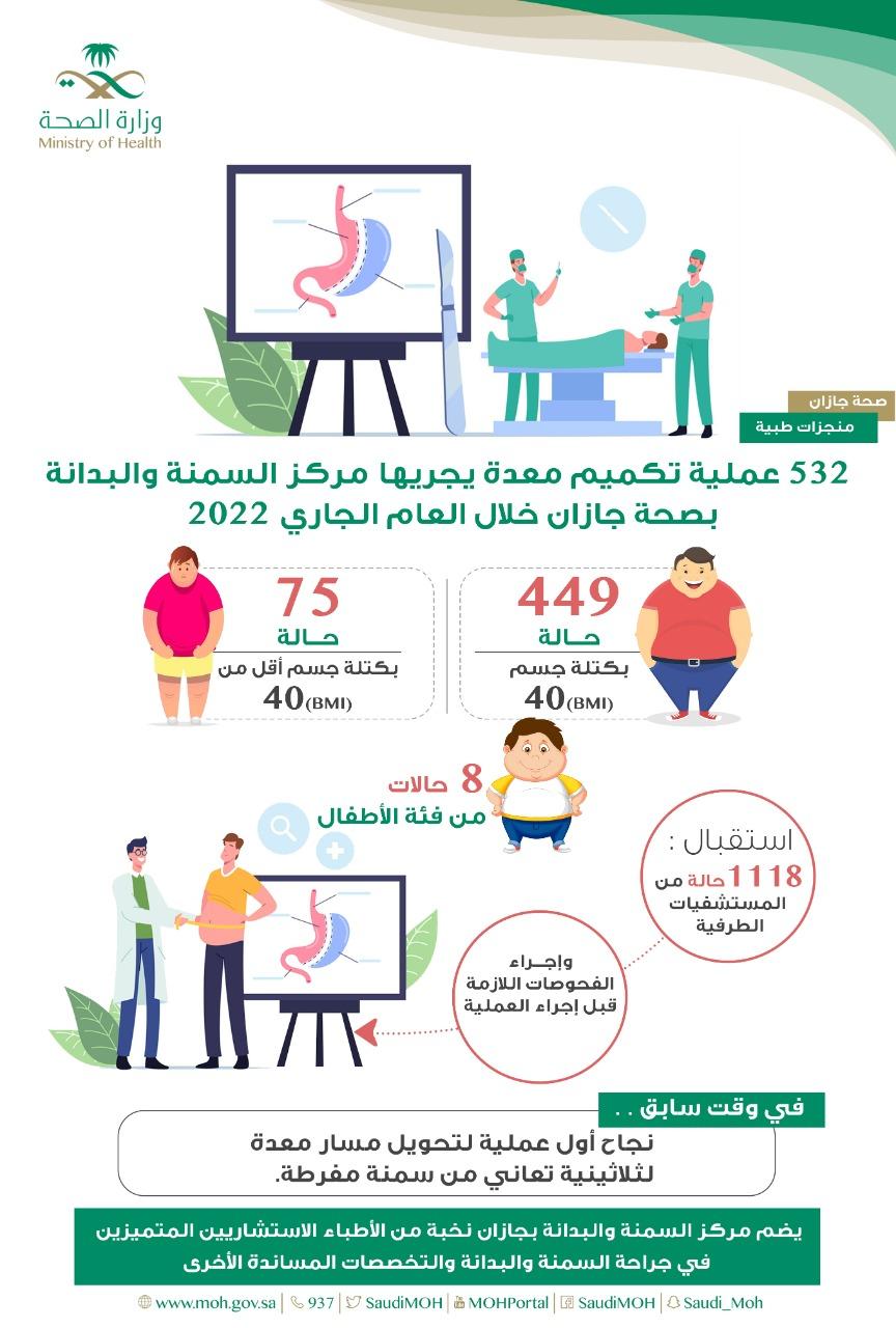 532 عملية تكميم معدة يجريها مركز السمنة والبدانة بصحة جازان خلال العام الميلادي الجاري 2022م