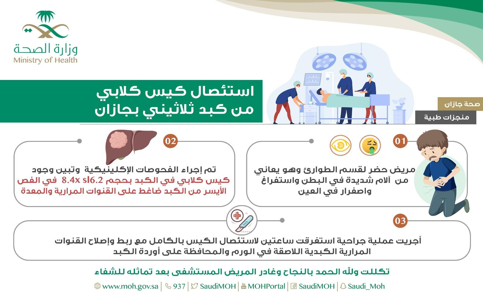 استئصال كيس  كلابي  من  كبد  ثلاثيني بجازان