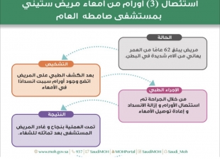 فريق طبي بمستشفى صامطة ينجح في استئصال ثلاث أورام من أمعاء مريض