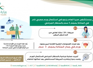 فريق طبي بمستشفى صبيا العام ينجح في استئصال ورم عصبي نادر في المثانة بحجم  3 سم بالمنظار الجراحي