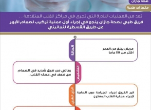 نجاح تركيب صمام الأبهر عن طريق القسطرة بمستشفى الأمير محمد بن ناصر في جازان