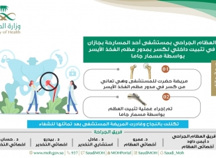 فريق العظام الجراحي بمستشفى أحد المسارحة ينجح في تثبيت داخلي لكسر بمدور عظم  الفخذ الأيسر بواسطة مسمار جاما